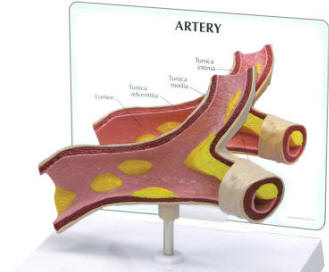 Cholesterol+deposits+on+eyes