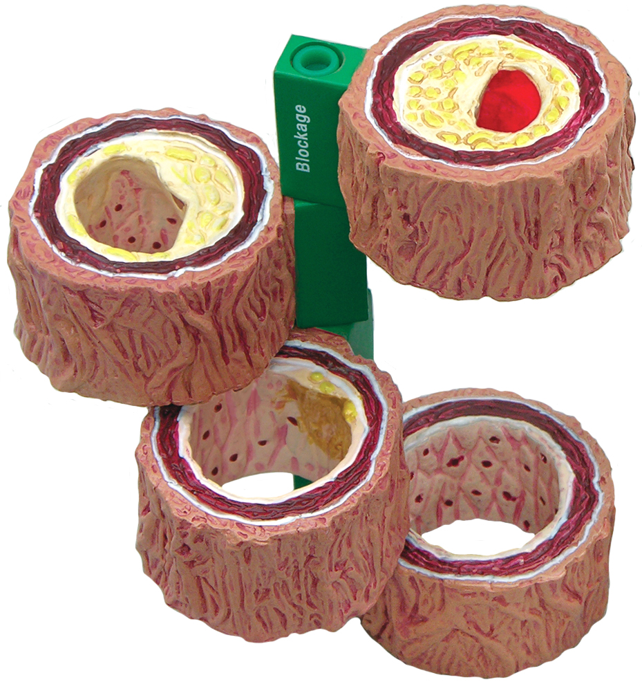 Functional model shows how the circulatory system works