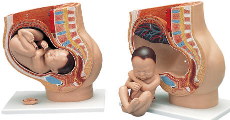 Pregnancy pelvis model shows fetus positioned for birth